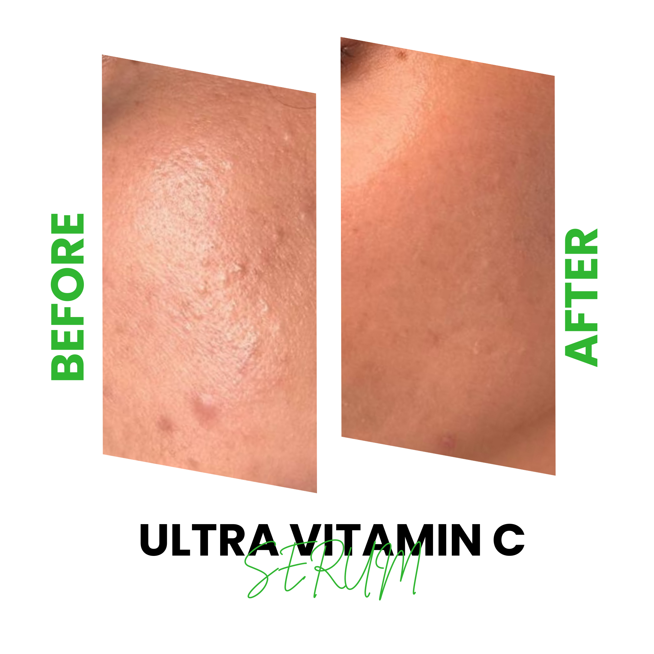 Ultra Vitamin C Serum